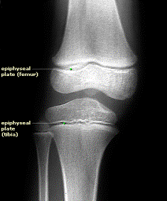 Bone Growth Team Bone