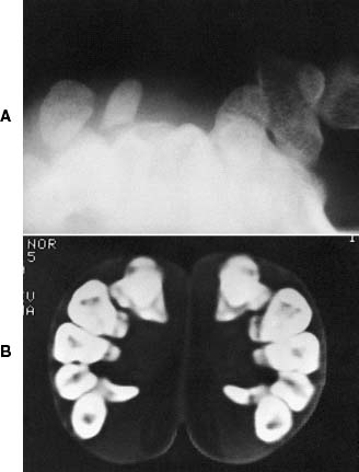 radiographs