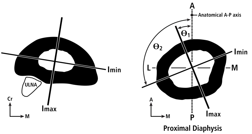 Biomechanics of Bone | Team Bone